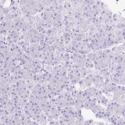 Immunohistochemistry-Paraffin: SLC8A2 Antibody [NBP2-49145]