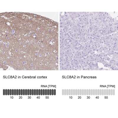 Immunohistochemistry-Paraffin: SLC8A2 Antibody [NBP2-49145]