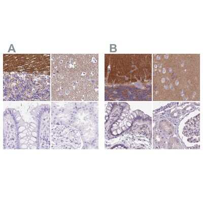 Immunohistochemistry-Paraffin: SLC8A2 Antibody [NBP2-49145]