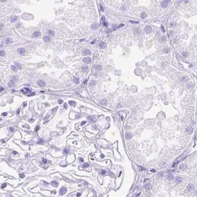 Immunohistochemistry-Paraffin: SLC8A2 Antibody [NBP2-49145]