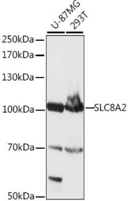 Western Blot: SLC8A2 AntibodyAzide and BSA Free [NBP2-93474]