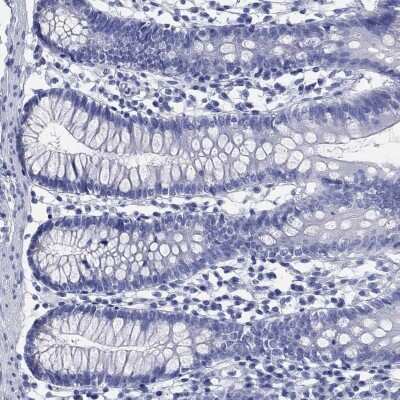 Immunohistochemistry-Paraffin: SLC9A11 Antibody [NBP3-16967]
