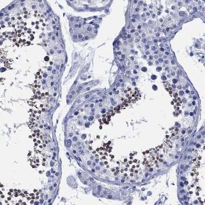 Immunohistochemistry-Paraffin: SLC9A11 Antibody [NBP3-16967]