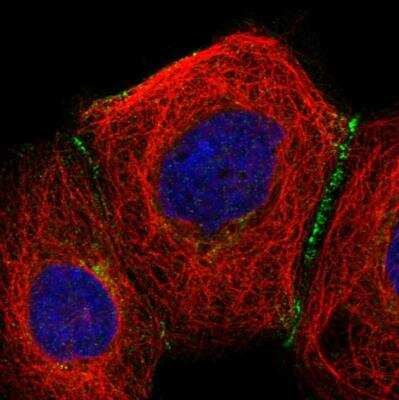 Immunocytochemistry/ Immunofluorescence: SLC9A2 Antibody [NBP1-82576]