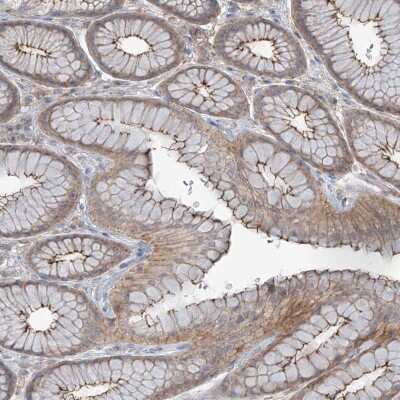 Immunohistochemistry-Paraffin: SLC9A2 Antibody [NBP1-82576]