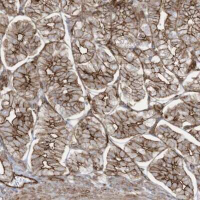 Immunohistochemistry-Paraffin: SLC9A2 Antibody [NBP2-38236]
