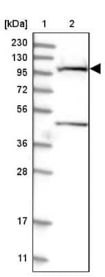 Western Blot: SLC9A2 Antibody [NBP2-38236]