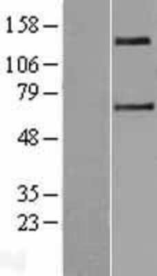 Western Blot: SLC9A2 Overexpression Lysate [NBP2-04240]