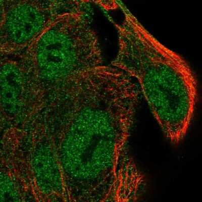 Immunocytochemistry/ Immunofluorescence: SLC9A4 Antibody [NBP2-38280]