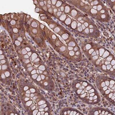Immunohistochemistry-Paraffin: SLC9A5 Antibody [NBP1-80996]