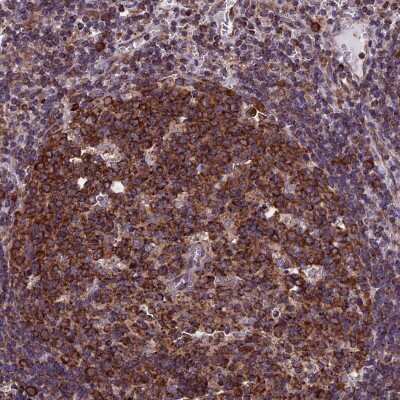 Immunohistochemistry-Paraffin: SLC9A5 Antibody [NBP1-80997]