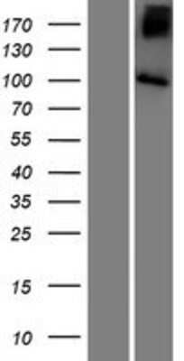 Western Blot: SLC9A5 Overexpression Lysate [NBP2-07848]