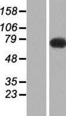 Western Blot: NHE6/SLC9A6 Overexpression Lysate [NBP2-07631]