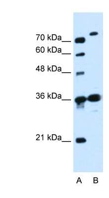 Western Blot: SLC9A7 Antibody [NBP1-62455]