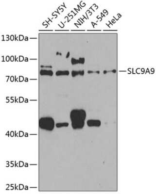 Western Blot: SLC9A9 AntibodyBSA Free [NBP2-95245]