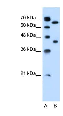 Western Blot: SLCO1A2 Antibody [NBP1-59658]