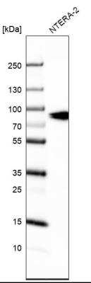 Western Blot: SLCO1A2 Antibody [NBP2-56965]