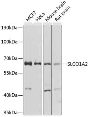 Western Blot: SLCO1A2 AntibodyAzide and BSA Free [NBP2-94661]