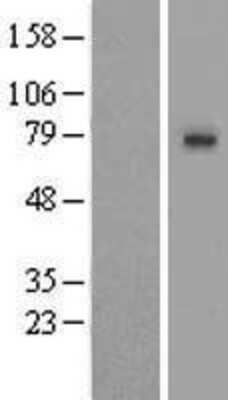 Western Blot: SLCO1A2 Overexpression Lysate [NBL1-16201]