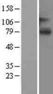 Western Blot: SLCO1A2 Overexpression Lysate [NBL1-16202]