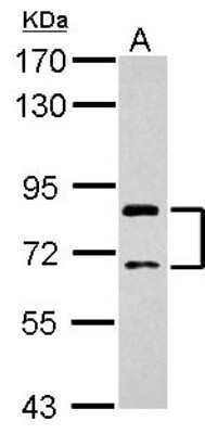 Western Blot: SLCO1C1 Antibody [NBP2-20396]