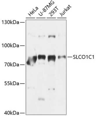 Western Blot: SLCO1C1 AntibodyBSA Free [NBP2-93140]