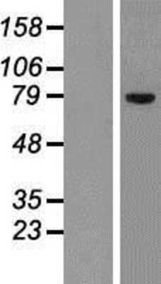 Western Blot: SLCO1C1 Overexpression Lysate [NBP2-06985]