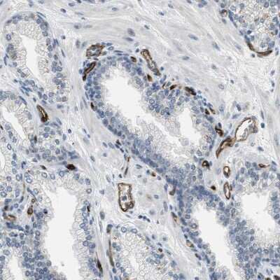 Immunohistochemistry-Paraffin: SLCO2A1 Antibody [NBP2-13349]