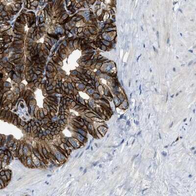 Immunohistochemistry-Paraffin: SLCO2A1 Antibody [NBP2-13349]