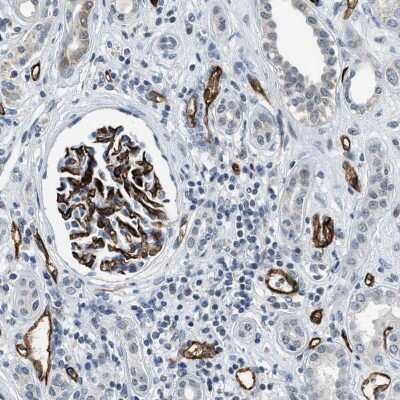 Immunohistochemistry-Paraffin: SLCO2A1 Antibody [NBP2-13349]
