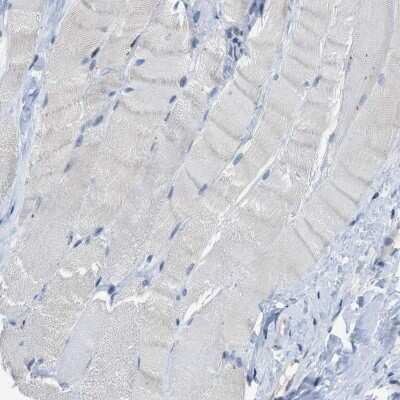 Immunohistochemistry-Paraffin: SLCO2A1 Antibody [NBP2-13349]