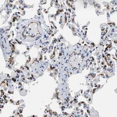 Immunohistochemistry-Paraffin: SLCO2A1 Antibody [NBP2-13349]
