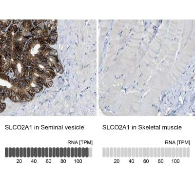 Immunohistochemistry-Paraffin: SLCO2A1 Antibody [NBP2-13349]