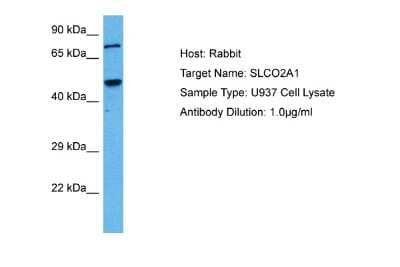 Western Blot: SLCO2A1 Antibody [NBP2-83558]