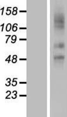 Western Blot: SLCO2A1 Overexpression Lysate [NBL1-16205]