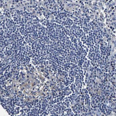 Immunohistochemistry-Paraffin: SLCO2B1 Antibody [NBP1-80979]