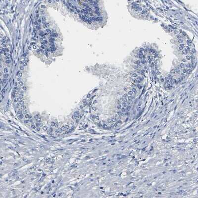 Immunohistochemistry-Paraffin: SLCO2B1 Antibody [NBP1-80979]