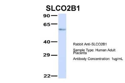 Western Blot: SLCO2B1 Antibody [NBP1-59811]