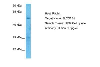 Western Blot: SLCO2B1 Antibody [NBP2-85771]