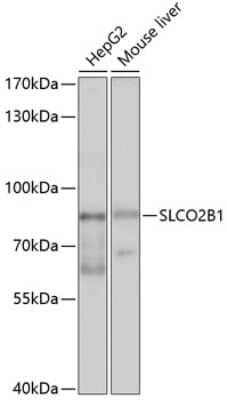 Western Blot: SLCO2B1 AntibodyBSA Free [NBP2-94572]