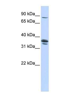 Western Blot: SLCO3A1 Antibody [NBP1-59678]