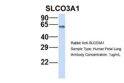 Western Blot: SLCO3A1 Antibody [NBP1-59678]