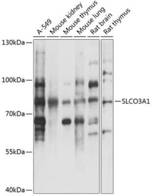 Western Blot: SLCO3A1 AntibodyAzide and BSA Free [NBP3-05037]