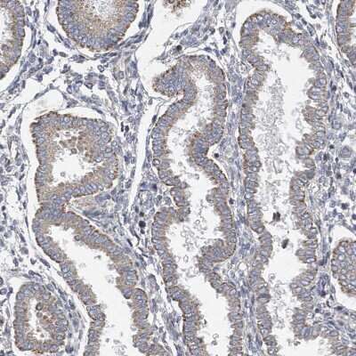Immunohistochemistry-Paraffin: SLCO4A1 Antibody [NBP1-80977]