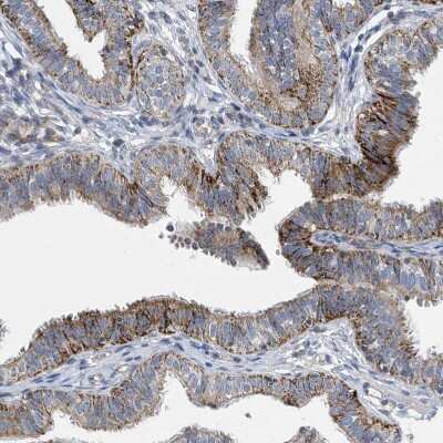 Immunohistochemistry-Paraffin: SLCO4A1 Antibody [NBP1-80977]
