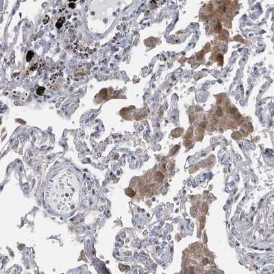 Immunohistochemistry-Paraffin: SLCO4A1 Antibody [NBP1-80977]