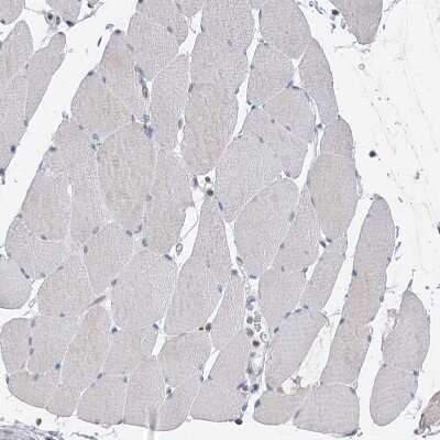 Immunohistochemistry-Paraffin: SLCO4A1 Antibody [NBP1-80977]
