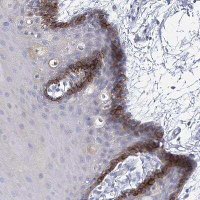 Immunohistochemistry-Paraffin: SLCO4A1 Antibody [NBP1-80978]