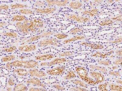 Immunohistochemistry-Paraffin: SLCO4C1 Antibody [NBP3-06278]