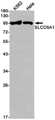 Western Blot: SLCO5A1 Antibody (S02-5J4) [NBP3-19774]